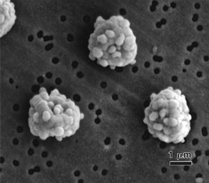 a-fumigatus(1)