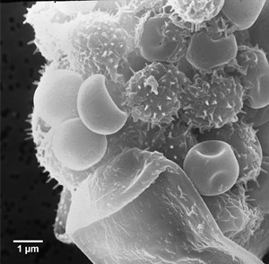 m-racemosus-f-microsporus