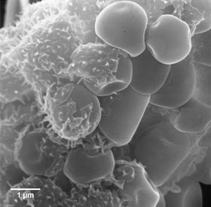 m-racemosus-f-microsporus(1)