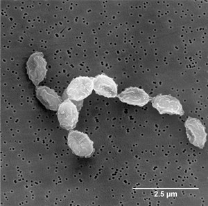 p-variabile