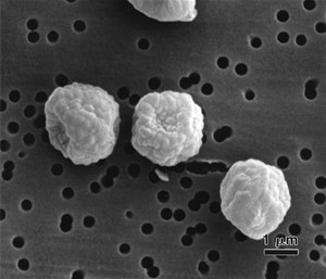 p-verrucosum(1)