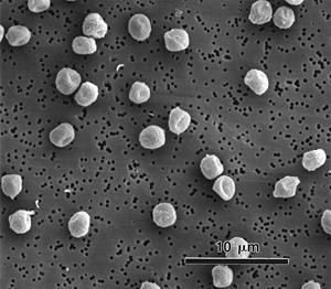 p-verrucosum1