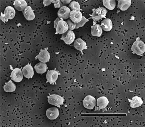 rhizomucor-pusillus