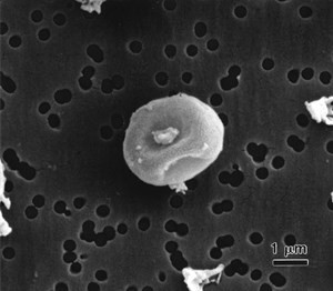 rhizomucor-pusillus(1)