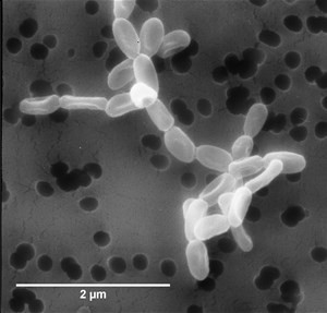 streptomyces-flavovirens1